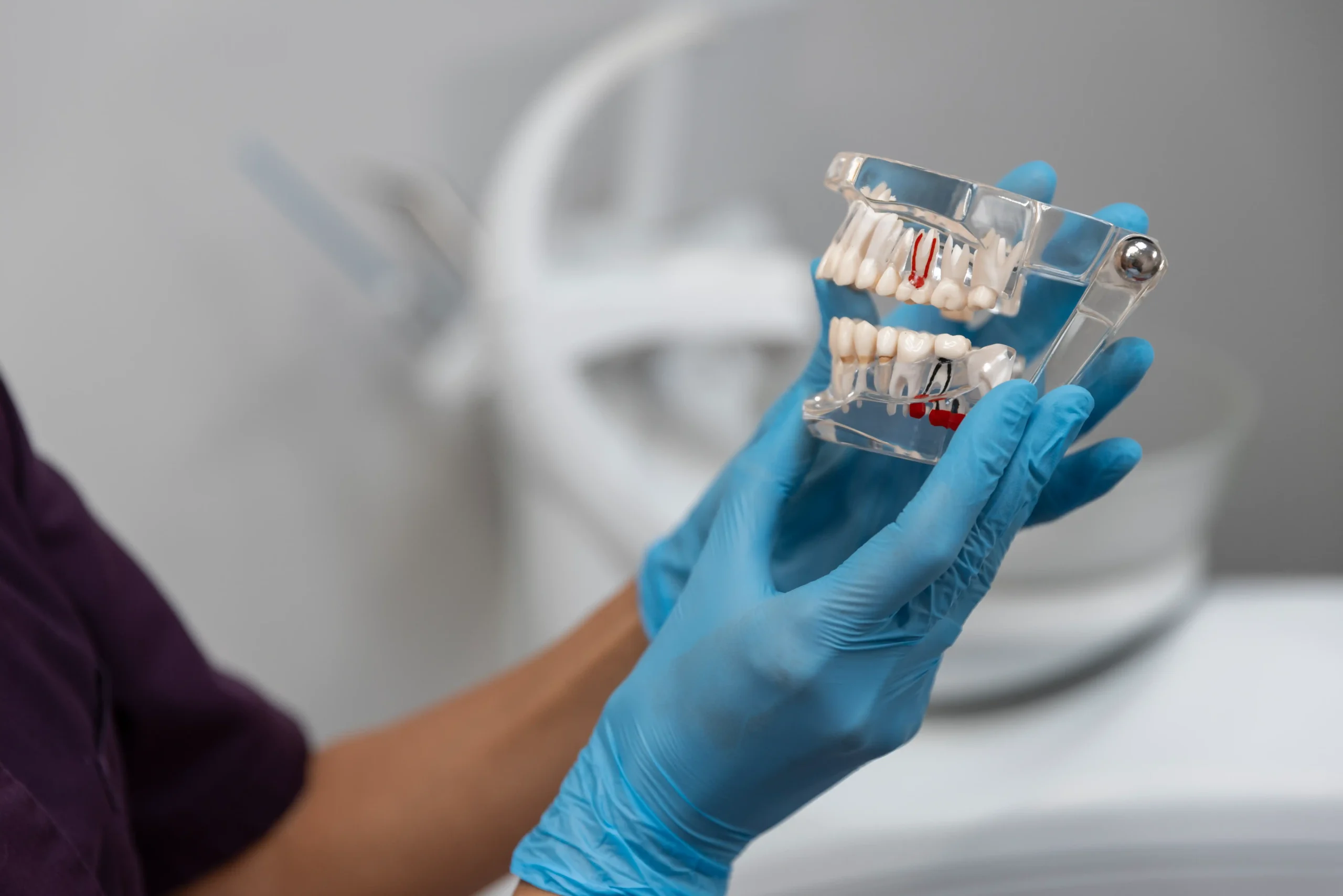 Dental Implants services
