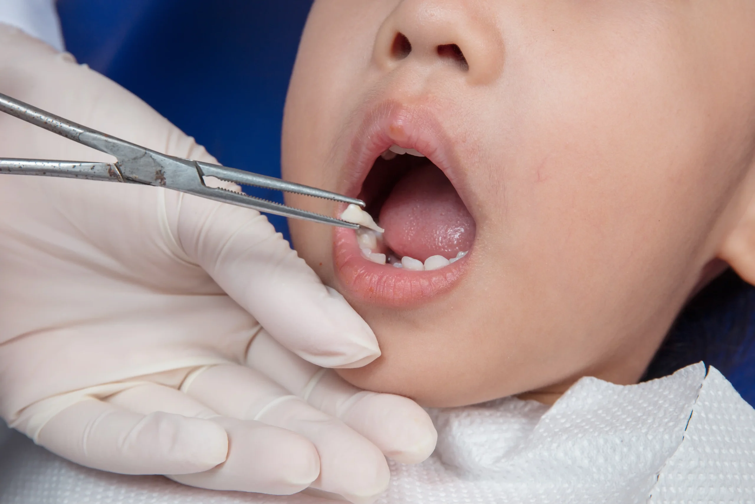 Pediatric Dentistry In Cudahy