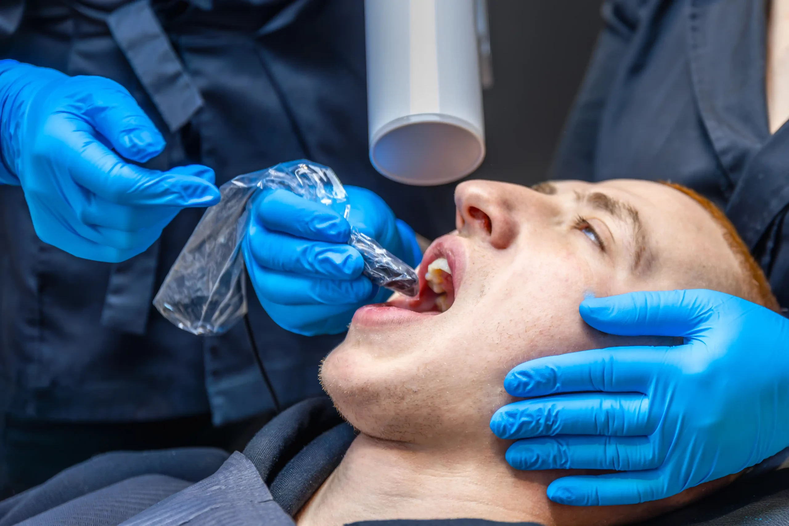 Wisdom Tooth Extraction