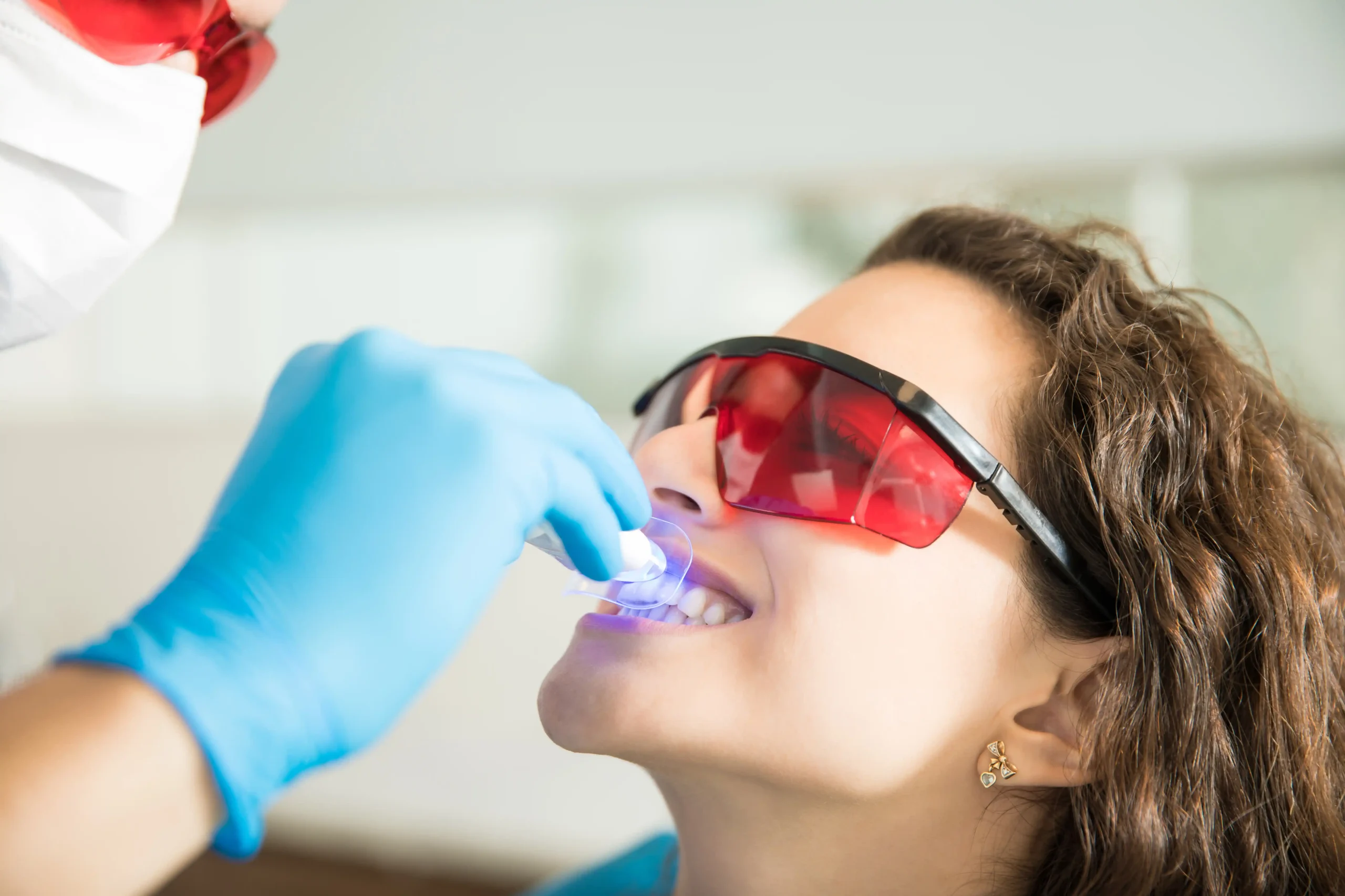 Teeth whiting service