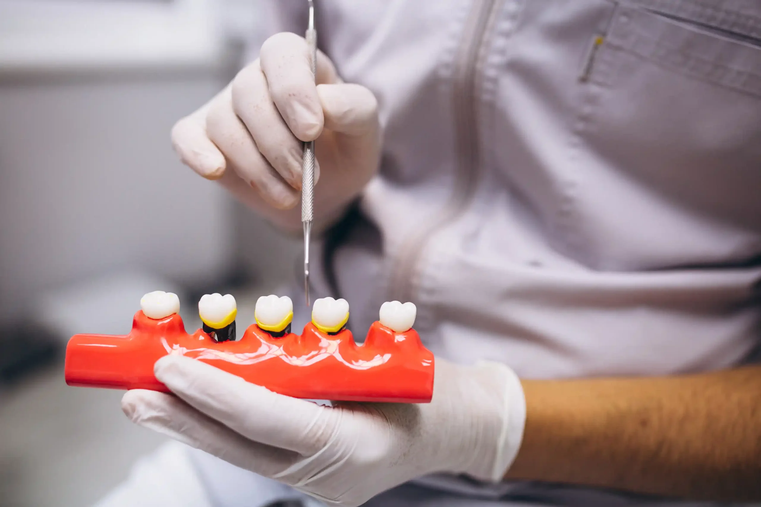 Dental Crown