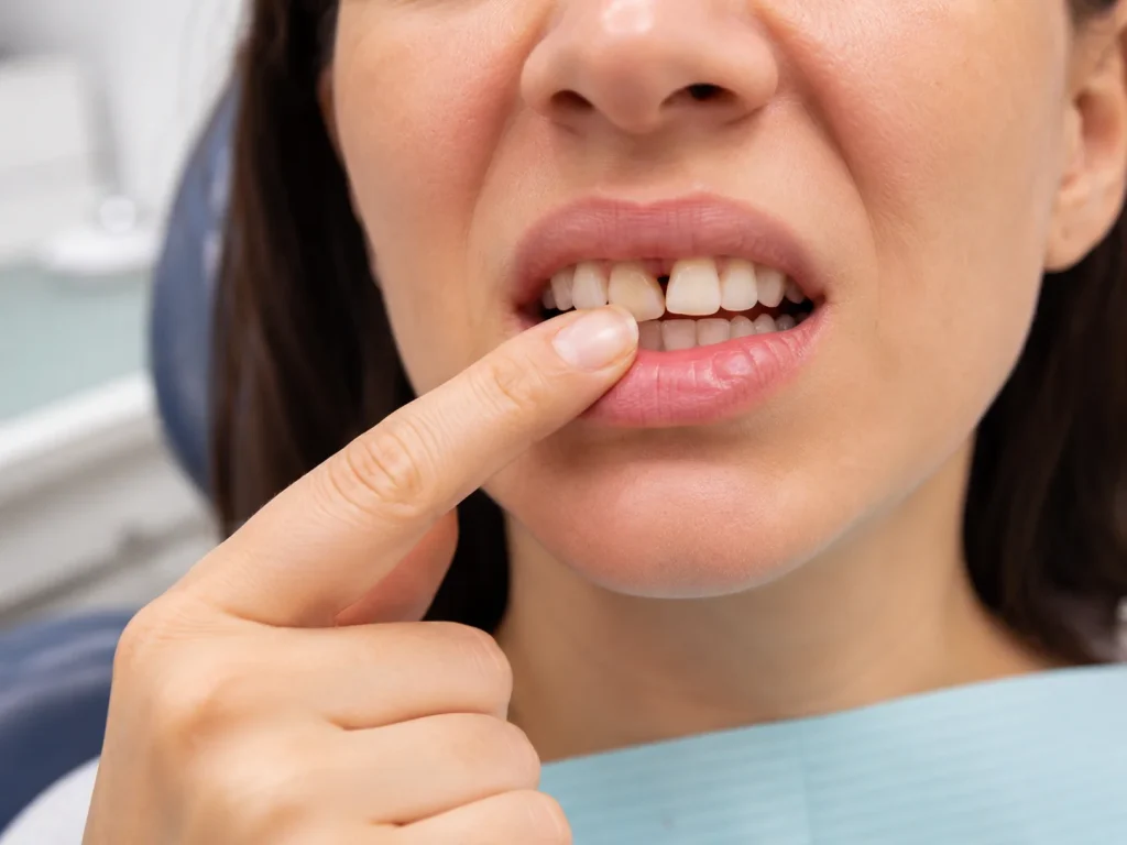 Woman pressing front tooth due to loose permanent tooth.