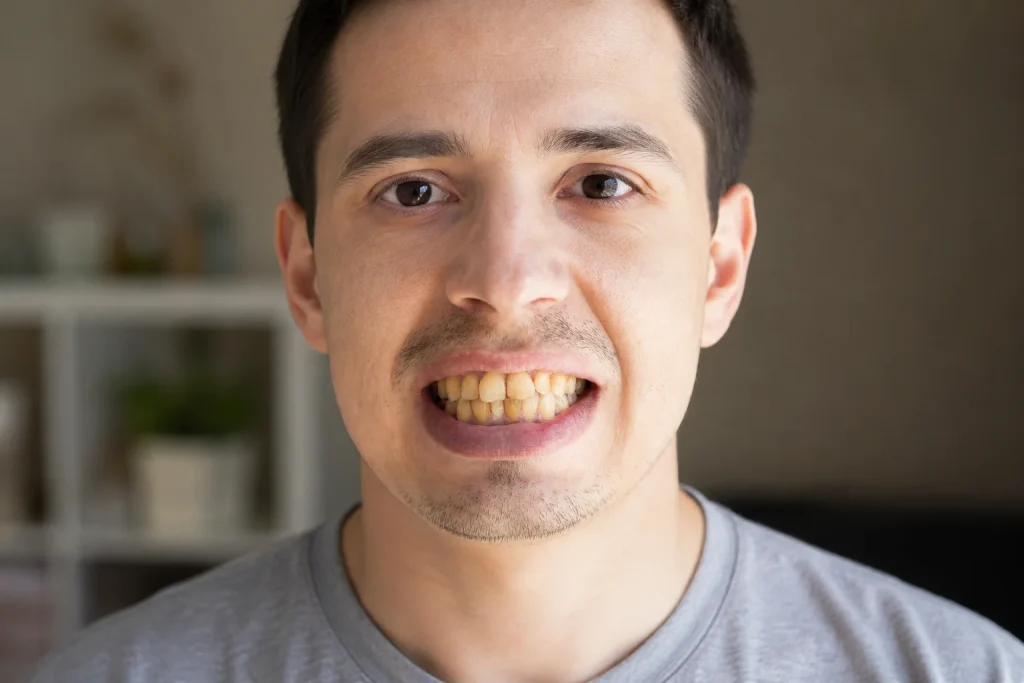 Portrait of man with yellow teeth and slight smile
