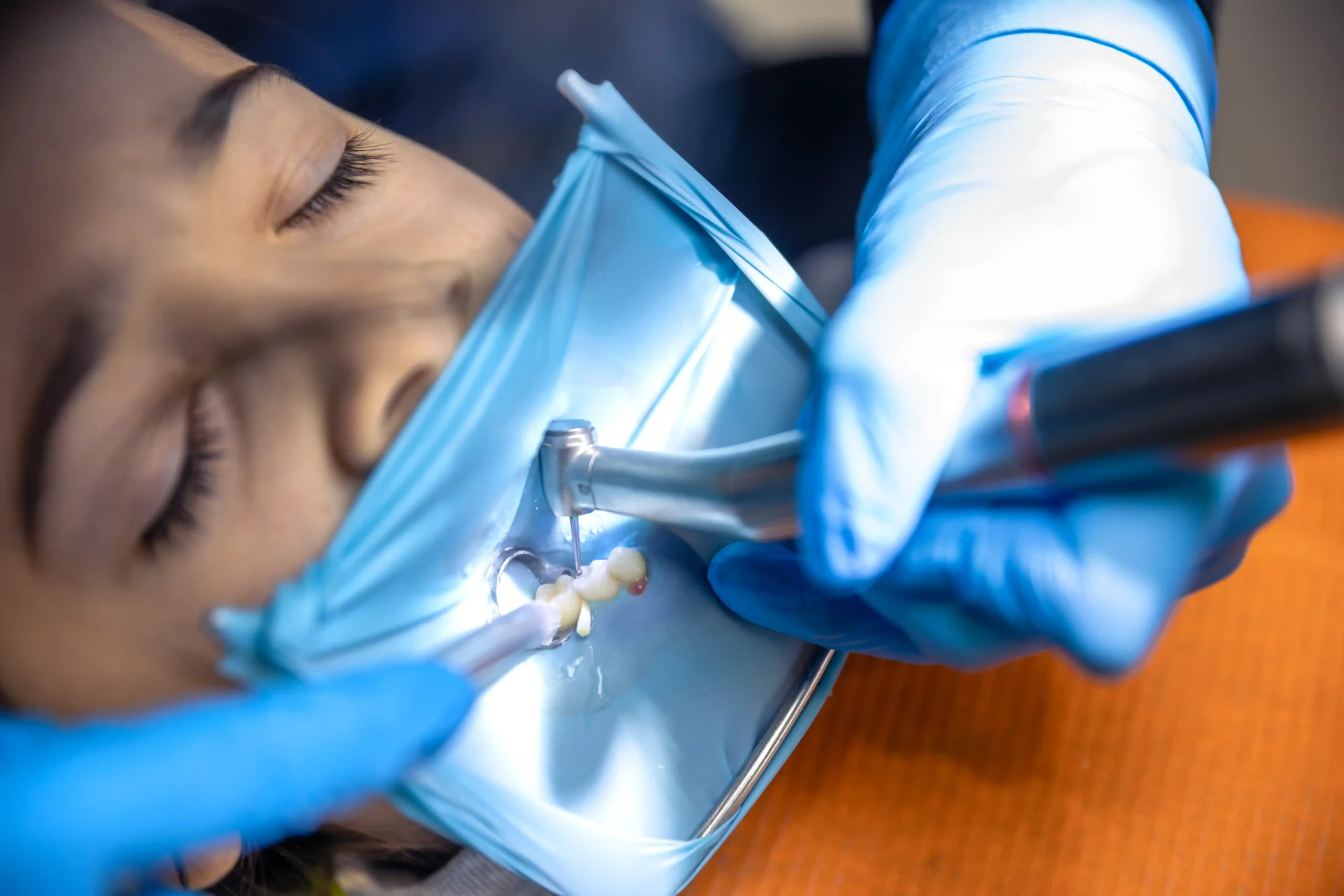 endodontic therapy In Cudahy WI scaled