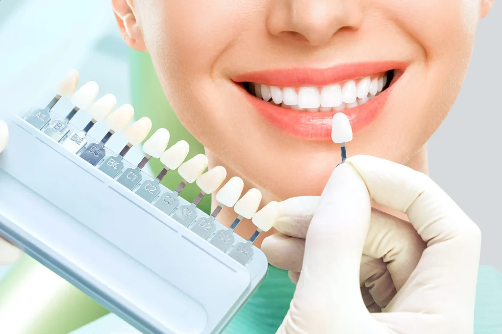 Teeth Whitening Cost