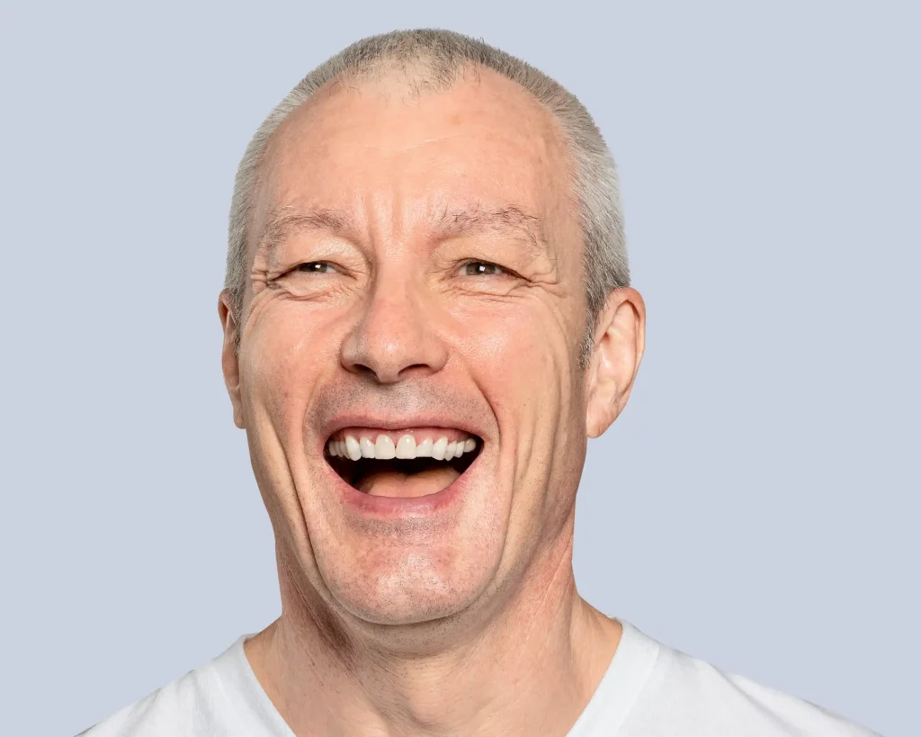 partial dentures price
