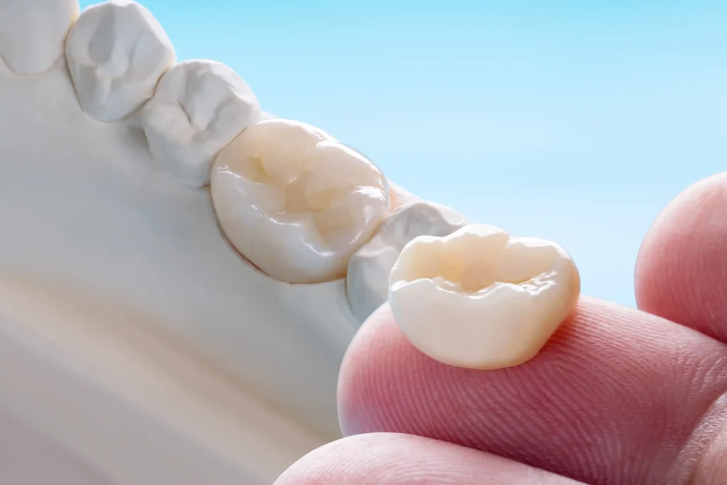 Porcelain crown price for a dental implant restoration on a tooth model