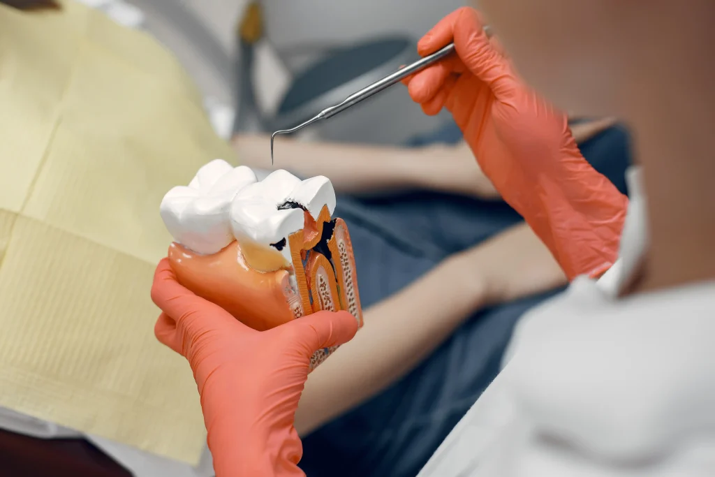 Root canal tooth anatomy model showing the inner pulp and nerve structure