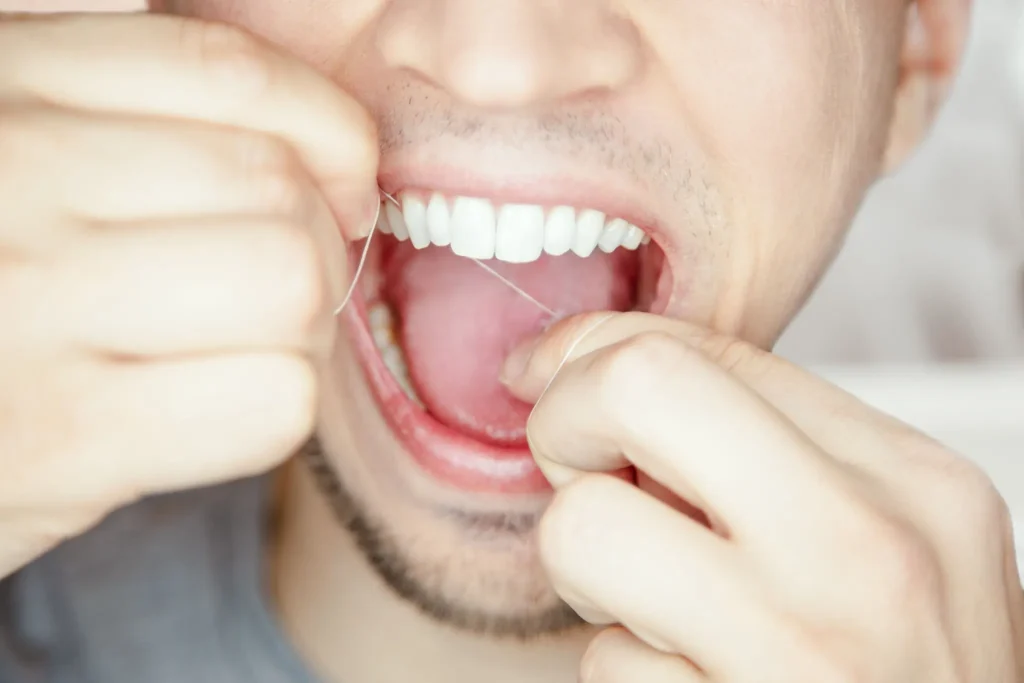 Poor Flossing Habits cause gums bleeding