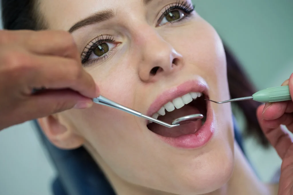 Dental Bonding Before and After treatment using a curing light