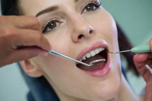 Dental Bonding Before and After treatment using a curing light