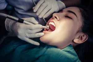 Can you sleep during a dental filling procedure