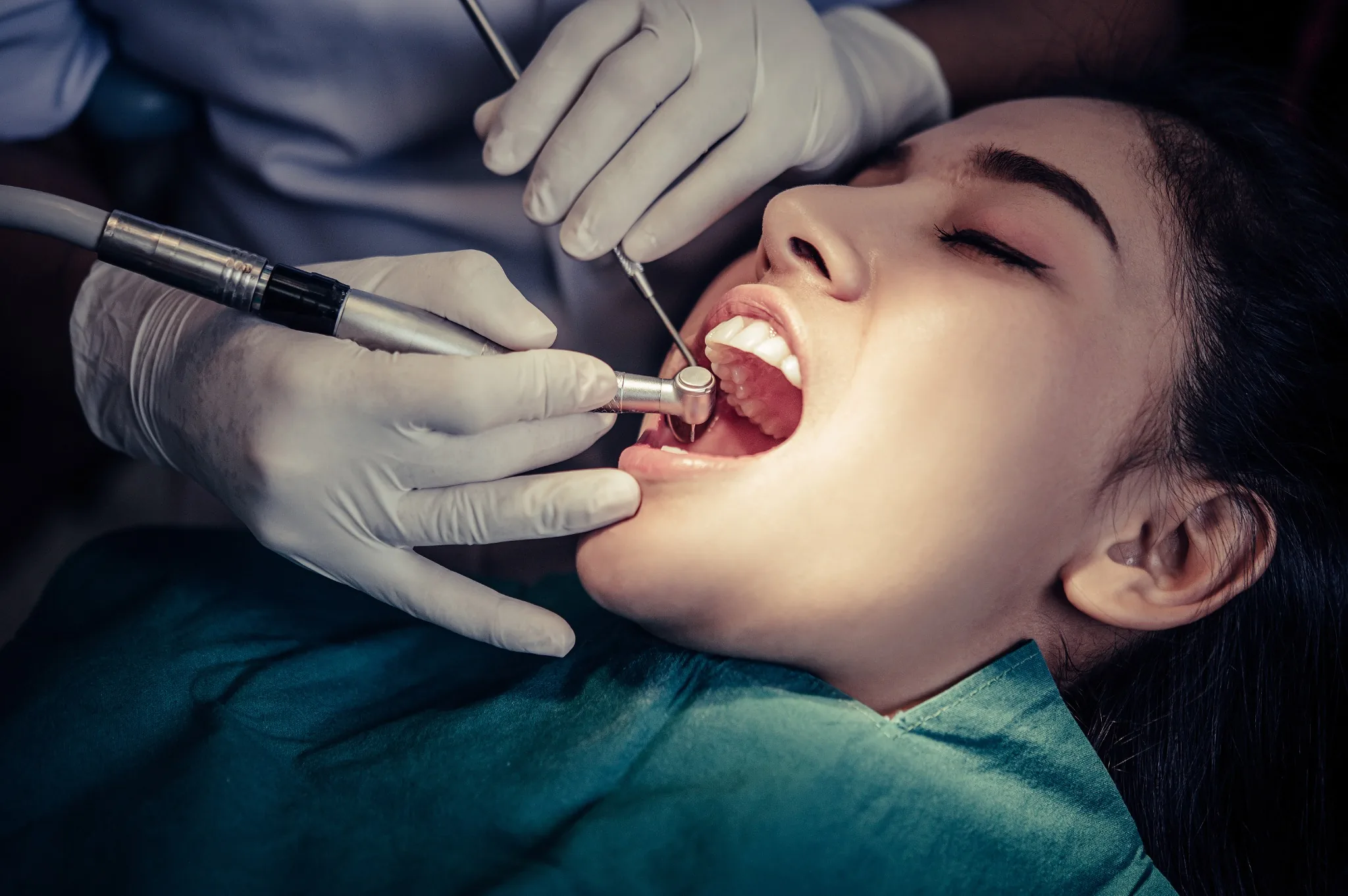Can you sleep during a dental filling procedure